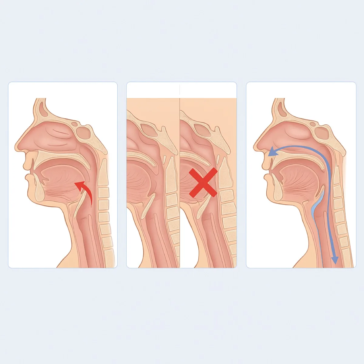 Three airway diagrams: collapsed, blocked, and held open